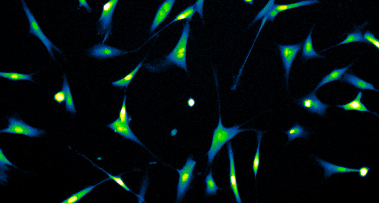 Normal Er The impact of Endoplasmic Reticulum (ER) in the skin - Oxiproteomics