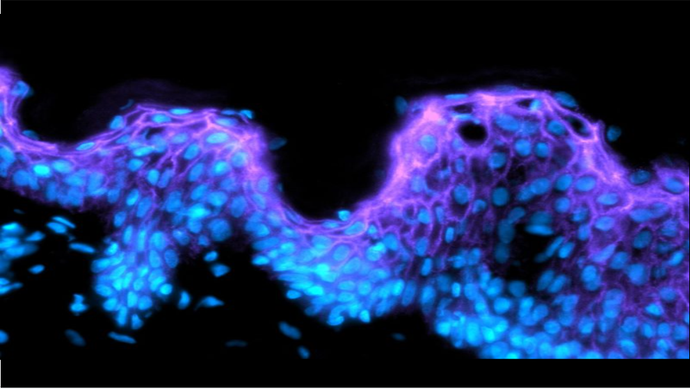 proteome oxiproteomics