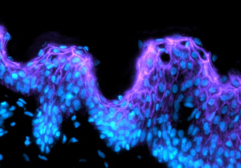 proteome oxiproteomics